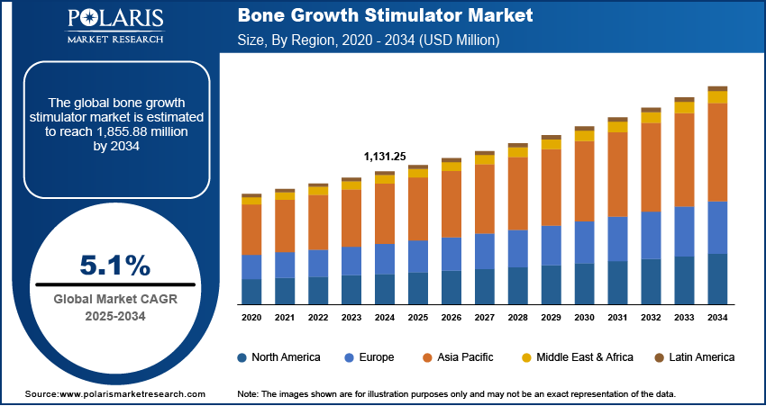 Bone Growth Stimulator Market Size